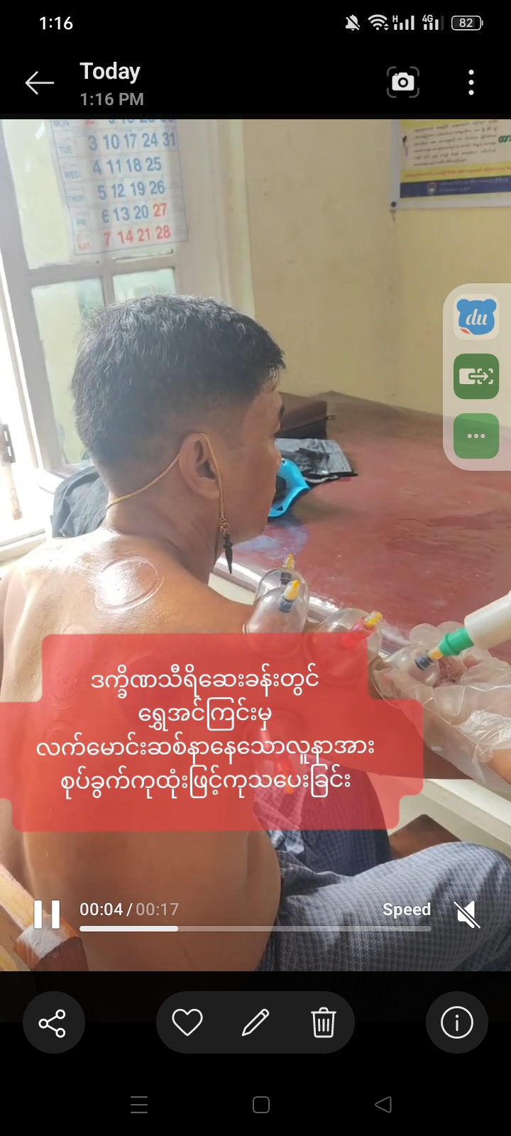ဒက္ခိဏသီရိဆေးခန်းတွင် ရွှေအင်ကြင်းမှ လက်မောင်းဆစ်နာနေသောလူနာအား စုပ်ခွက်ကုထုံးဖြင့်ကုသပေးခြင်း
