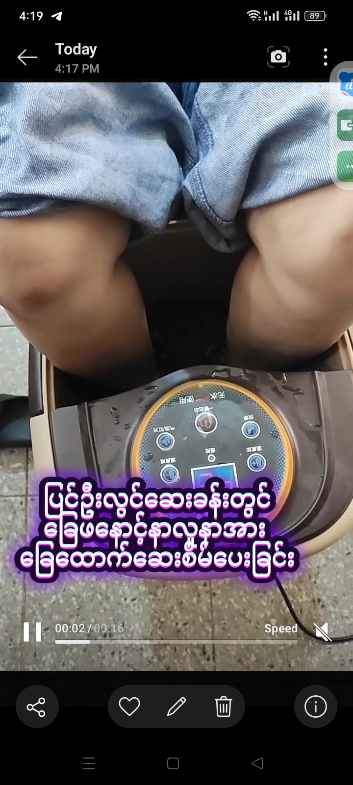 ပြင်ဦးလွင်ဆေးခန်းတွင် ခြေဖနောင့်နာလူနာအား ခြေထောက်ဆေးစိမ်ပေးခြင်း