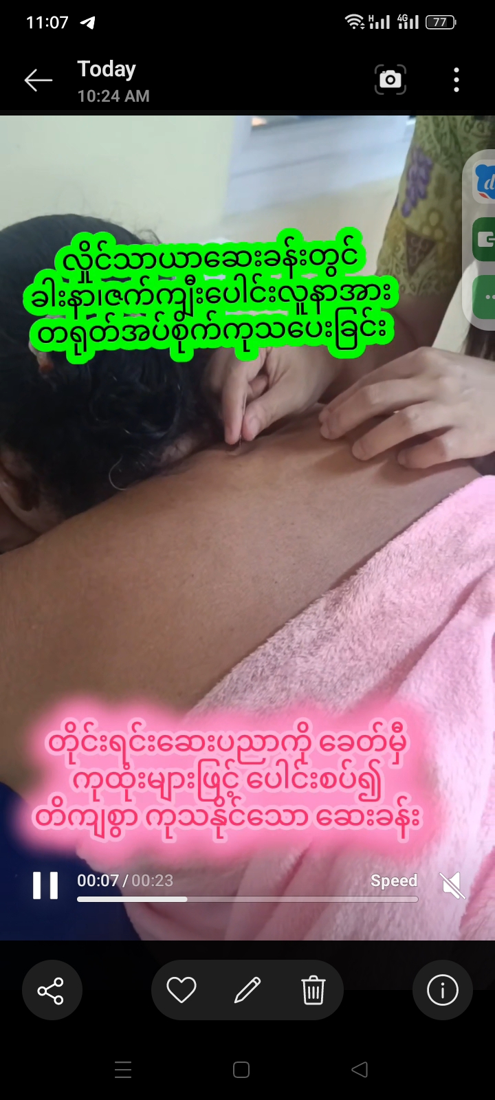 လိူင်သာယာဆေးခန်းတွင် ခါးနာ၊ဇက်ကျီးပေါင်းလူနာအား တရုတ်အပ်စိုက်ကုသပေးခြင်း
