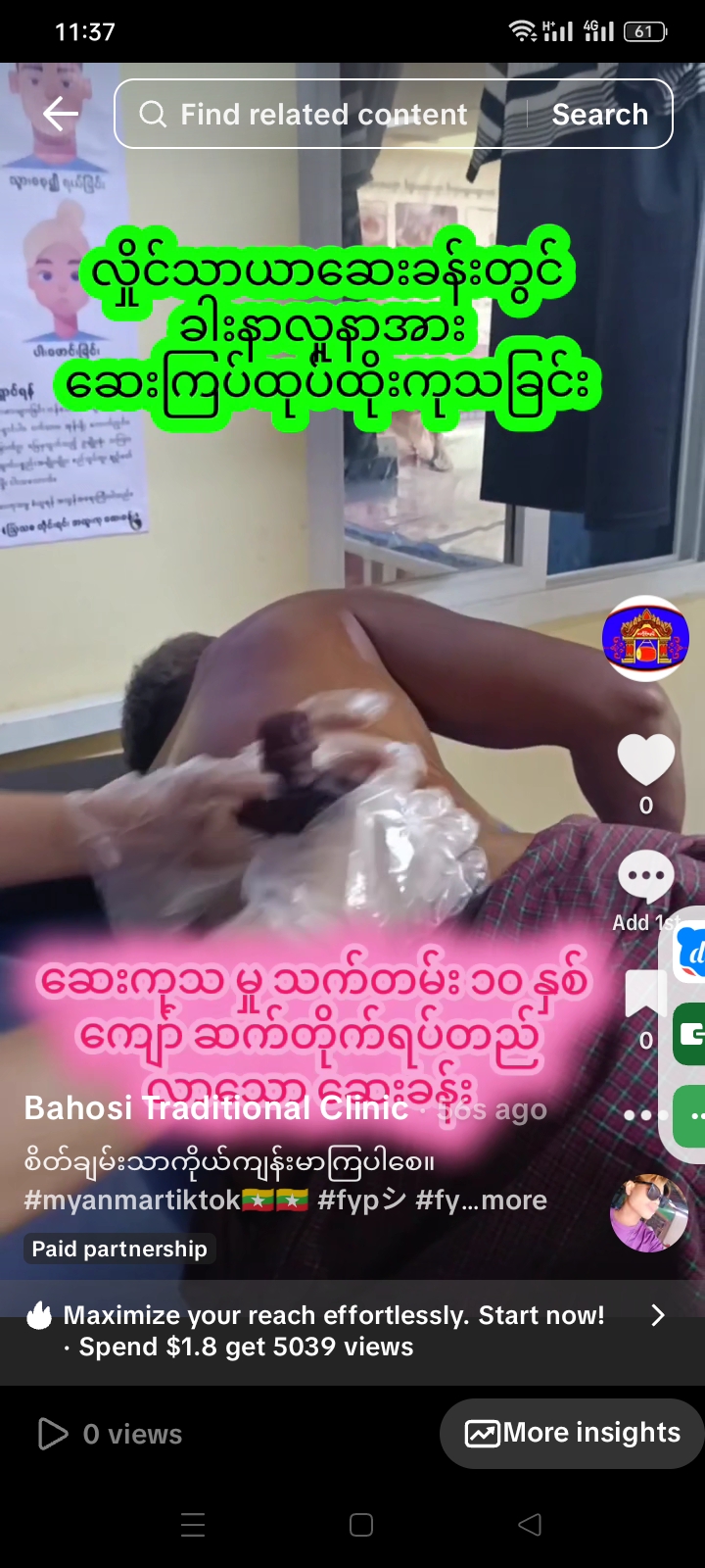 လှိုင်သာယာဆေးခန်းတွင် ခါးနာလူနာအား  ဆေးကြပ်ထုပ်ထိုးကုသခြင်း