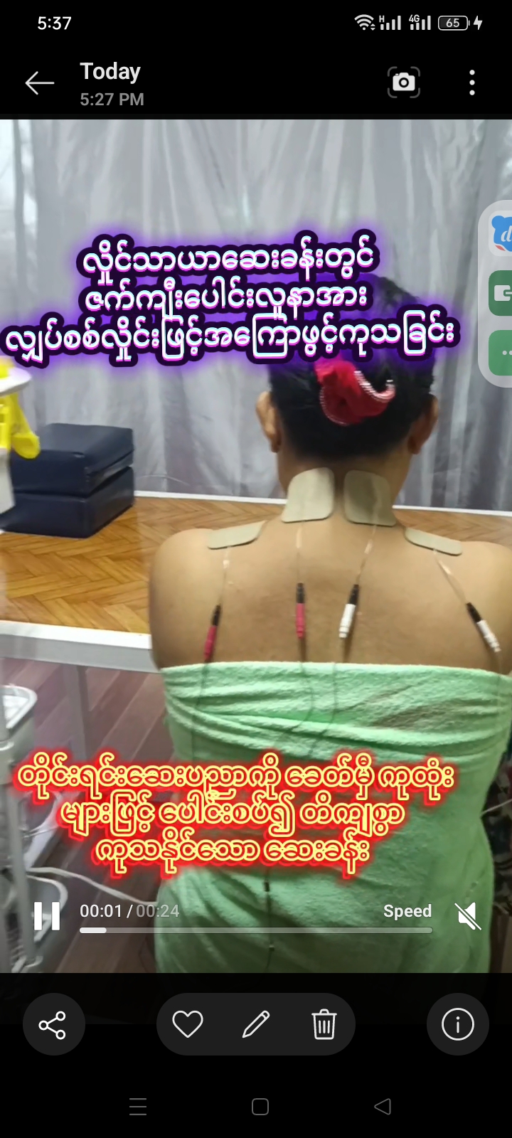 လှိုင်သာယာဆေးခန်းတွင် ဇက်ကျီးပေါင်းလူနာအား လျပ်စစ်လှိုင်းဖြင့်အကြောဖွင့်ကုသခြင်း